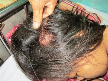 Nghi án CSGT “ra gậy”, thai phụ nguy kịch nhập viện