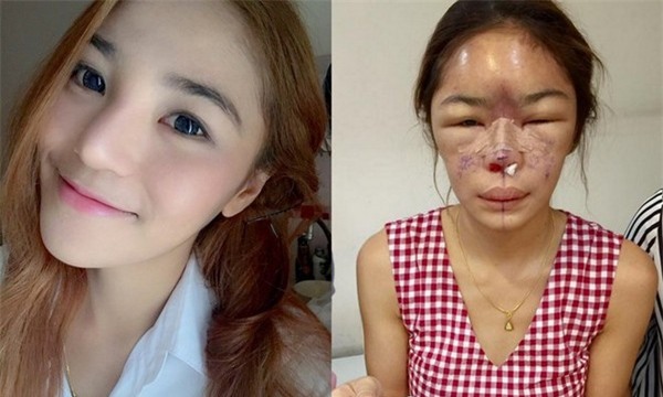 Sốc trước gương mặt nát bét của hot girl Thái Lan - Ảnh 1 Sốc trước gương mặt nát bét của hot girl Thái Lan - Ảnh 1