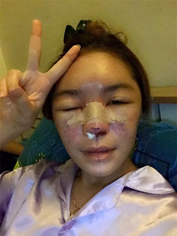 Sốc trước gương mặt nát bét của hot girl Thái Lan - Ảnh 3 Sốc trước gương mặt nát bét của hot girl Thái Lan - Ảnh 3