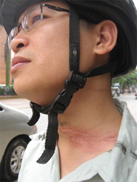 Sống ở Hà Nội, cần phải biết những nguy hiểm chết người này! - Ảnh 19 Sống ở Hà Nội, cần phải biết những nguy hiểm chết người này! - Ảnh 19