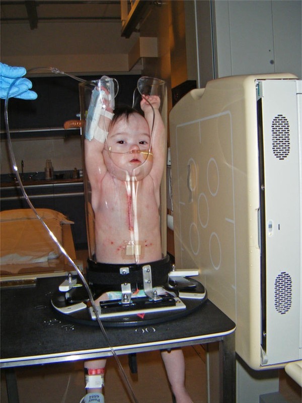 Hình ảnh em bé bị nhồi nhét chật cứng trong ống nghiệm - Ảnh 5