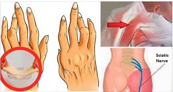 dầu thầu dầu chữa đau lưng dầu thầu dầu chữa đau lưng