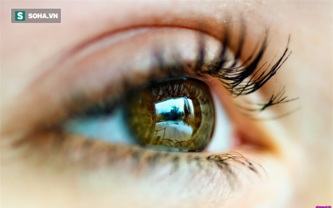 Cảnh báo: Người có dấu hiệu này ở mắt có thể sắp đột quỵ