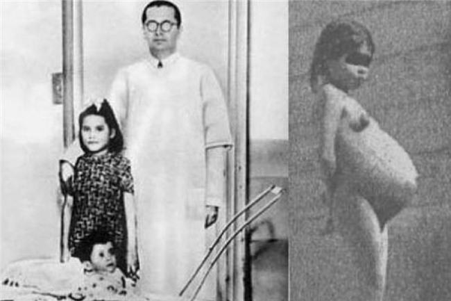 Bé gái mang thai và sinh con khi mới chỉ 5 tuổi: Câu chuyện kỳ lạ gây xôn xao dư luận thế giới suốt gần 80 năm qua - Ảnh 5.