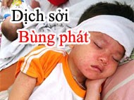 Dịch sởi bùng phát