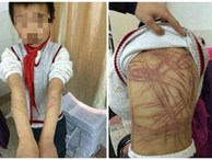 “Mẹ hổ” đánh đập con dã man vì không làm bài tập về nhà 