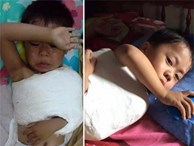 Cha mẹ chết vì TNGT, bé 3 tuổi trọng thương hoảng loạn gọi mẹ từng đêm