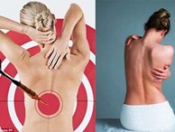 Một số biện pháp chữa đau lưng chỉ càng làm bệnh nặng thêm