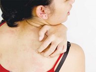 Cảnh báo 8 dấu hiệu ở da là triệu chứng của những bệnh cực nguy hiểm