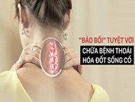 Cách đơn giản nhất để chữa bệnh thoái hóa đốt sống cổ, đau cổ