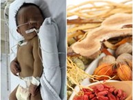 Hốt hoảng với những 'mẹo dân gian' chữa bệnh cho con của mẹ Việt