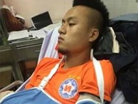 Võ Huy Toàn phải phẫu thuật 2 lần, nghỉ thi đấu 6 tháng