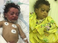 Hai em bé 1 tuổi sống sót thần kỳ trong cuộc tấn công đẫm máu