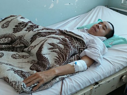 Người em trong cặp song sinh dính liền Việt - Đức phải nhập viện vì bệnh nặng