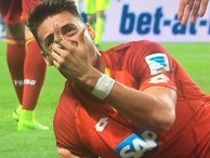 Sao Bundesliga gãy gập ngón tay kinh dị