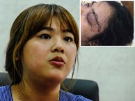Cô gái bị 20 thanh niên truy sát vì tố giác tội phạm: Mắt trái có nguy cơ mù hoàn toàn