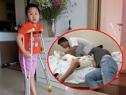 Câu chuyện ứa nước mắt về cậu bé bị gãy chân ở trường Nam Trung Yên