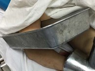 Mang bàn tay bị kẹt trong máy xay thịt tới bệnh viện