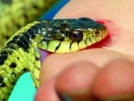 Ngày nào cũng có người bị rắn cắn nhập viện, BV Bạch Mai khuyến cáo 7 điều không được làm