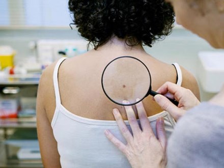 7 dấu hiệu ung thư da mà chúng ta không thể nhìn thấy bằng mắt thường 