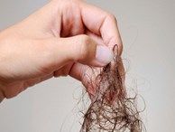 Tóc rụng quá nhiều, có thể bạn đang mắc phải một trong các thói quen xấu sau