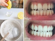 Thực tế làm trắng răng chỉ với 3 phút tại nhà bằng chanh muối hiệu quả đến đâu?