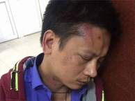 Bảo vệ bệnh viện phụ sản Hà Nội bị tố đánh người nhà bệnh nhân dã man
