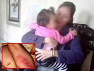 Sự thật bé gái 16 tháng tuổi nghi bị bạo hành tại điểm giữ trẻ tư nhân ở Huế