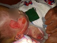 Vụ bé trai 15 tháng tuổi tử vong với nhiều vết thương lạ: Bệnh viện Nhi Thanh Hóa lên tiếng