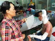 Nước mắt người mẹ bỏ việc lên Sài Gòn chăm con bị bỏng cồn nặng: 'Tôi sắp bị công ty cắt hợp đồng' 