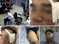 Vụ nổ súng bắn chủ quán cắt tóc ở Hà Nội: Do mâu thuẫn tình ái