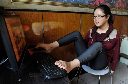 Hạnh phúc giản dị của cô gái cụt tay 3