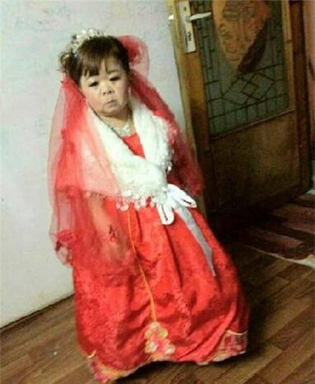 Chồng cao gấp đôi vợ, Phi thường - kỳ quặc, chuyen la, chuyen la the gioi, chuyen la trung quoc, cap doi dua lech, chong cao gap doi vo, tin tuc