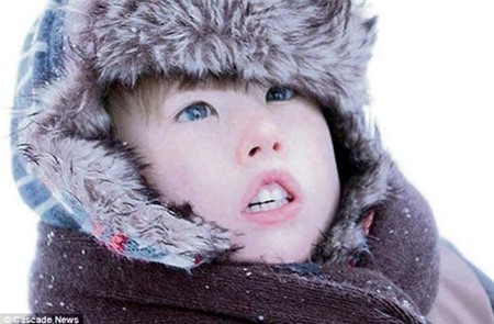 Gặp cậu bé không thể... mỉm cười, Phi thường - kỳ quặc, chuyen la, chuyen la the gioi, chuyen la co be, chuyen la cau be, cau be khong the mim cuoi, tin tuc