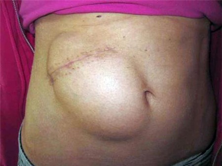 Những ca phẫu thuật cấy ghép không thể nào tin nổi 3