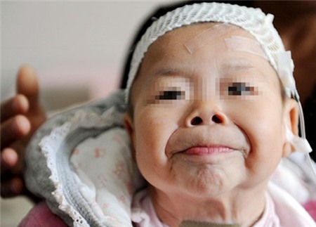 Xót xa những em bé trong hình hài cụ già 8