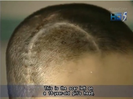 Kinh hoàng những phụ nữ