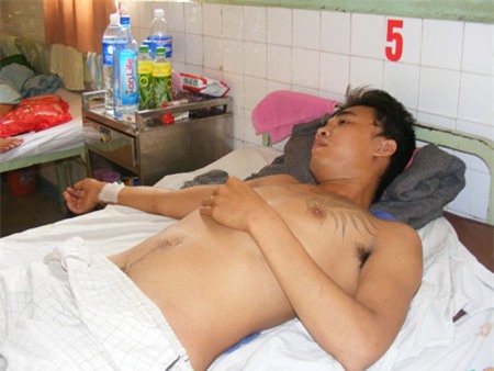 Nguyễn Văn Nghĩa đang được điều trị tại bệnh viện.