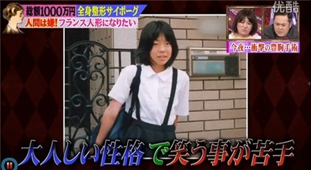 Nữ sinh Nhật thành búp bê Pháp sau 30 ca phẫu thuật 5