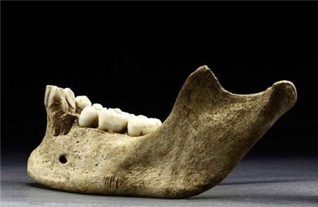 Vén màn bí ẩn thảm kịch ăn thịt người, Phi thường - kỳ quặc, tham kich an thit nguoi, Chuyen la, chuyện lạ, chuyenla, chuyen la co that, chuyen la kho tin