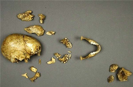 Vén màn bí ẩn thảm kịch ăn thịt người, Phi thường - kỳ quặc, tham kich an thit nguoi, Chuyen la, chuyện lạ, chuyenla, chuyen la co that, chuyen la kho tin