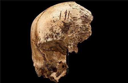 Vén màn bí ẩn thảm kịch ăn thịt người, Phi thường - kỳ quặc, tham kich an thit nguoi, Chuyen la, chuyện lạ, chuyenla, chuyen la co that, chuyen la kho tin