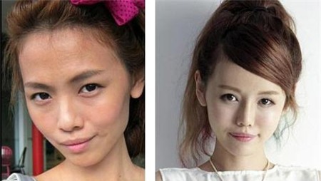 Singapore, Thái Lan, phẫu thuật thẩm mỹ