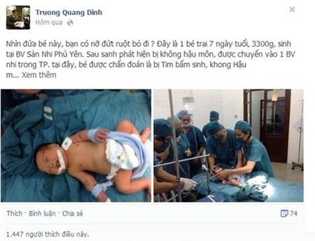 Chuyện kỳ diệu về bé sơ sinh bệnh nặng tình cờ được cứu 1