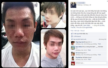 Choáng khi dị ứng mỹ phẩm biến người thành