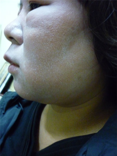 Choáng khi dị ứng mỹ phẩm biến người thành