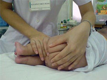 Tác dụng phụ của thuốc hạ sốt nhét hậu môn 1