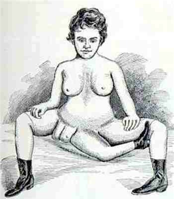 Chuyện tình cặp đôi cùng có 2 bộ phận sinh dục, Phi thường - kỳ quặc, cap doi cung co 2 bo phan sinh duc, Chuyen la, chuyện lạ, chuyenla, chuyen la co that, chuyen la kho tin