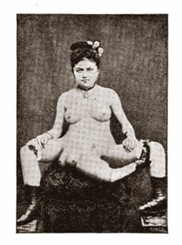 Chuyện tình cặp đôi cùng có 2 bộ phận sinh dục, Phi thường - kỳ quặc, cap doi cung co 2 bo phan sinh duc, Chuyen la, chuyện lạ, chuyenla, chuyen la co that, chuyen la kho tin