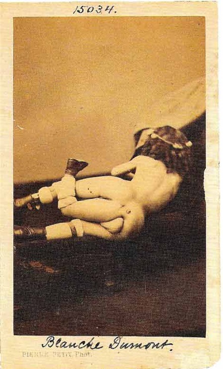 Chuyện tình cặp đôi cùng có 2 bộ phận sinh dục, Phi thường - kỳ quặc, cap doi cung co 2 bo phan sinh duc, Chuyen la, chuyện lạ, chuyenla, chuyen la co that, chuyen la kho tin